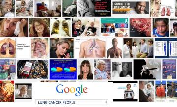 Lung cancer people
